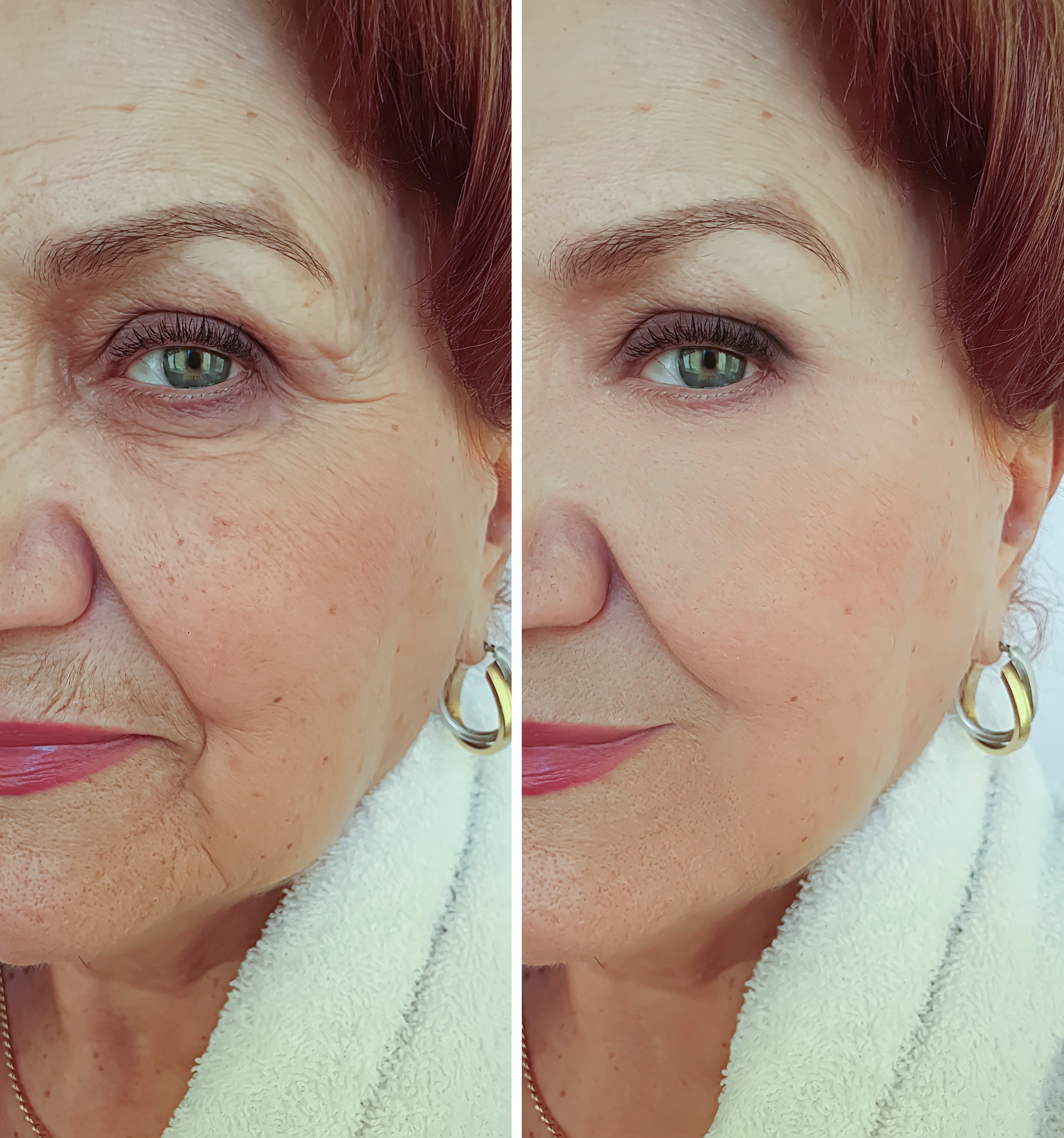 before and after photo of a woman's face